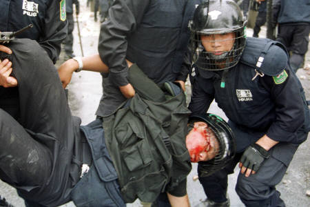 ▲ 시위대에 맞아 중상을 입은 전경대원. ⓒ 뉴데일리