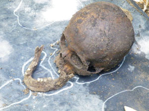 ▲ 수습된 유해 일부. ⓒ 뉴데일리