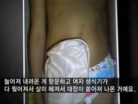 ▲ 지난 22일 방영된 KBS 1TV '시사기획 쌈' 화면 캡처.