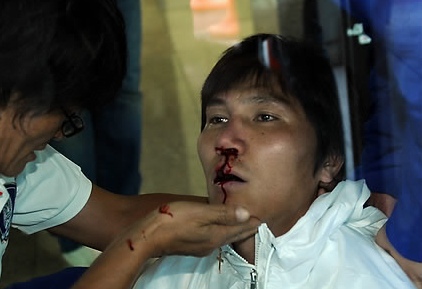 ▲ 러시아 프로축구 무대에서 활약하는 수비수 김동진(27.제니트)이 오는 14일 열릴 세네갈과 친선경기를 앞두고 8일 정오 대표팀 소집 중 파주NFC 본관 앞에서 의식을 잃고 쓰려져 최주영 팀닥터의 응급조치를 받고 있다. 김동진은 응급조치를 받은 후 급히 병원으로 후송됐다. ⓒ 스포츠조선-연합뉴스