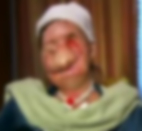 ▲ 침팬지에게 공격을 당한 사라 내쉬(Charla Nash&middot;55)의 얼굴 모습. ⓒ 유튜브 동영상 캡처&nbsp;