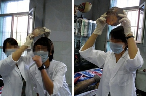 ▲ 적출한 신체를 들고 장난치는 학생들 ⓒ 뉴데일리