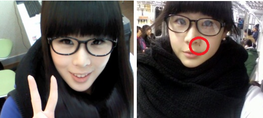 ▲ 좌측 사진이 신수지가 점을 뺀 후의 얼굴. 우측 사진은 과거 점(붉은 원)이 있을 때의 모습.  ⓒ  신수지 미니홈피 