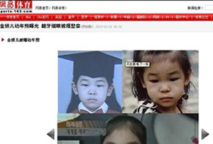 ▲ 중국 포털사이트 왕이는 김연아의 과거와 현재의 모습이 담긴 50여장의 사진을 공개하며 '성형설'을 뒷받침했다. ⓒ&nbsp;온바오닷컴 캡처&nbsp;