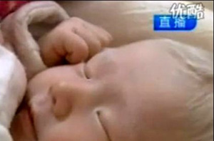 ▲ 온몸의 털이 하얀 여자아기 ⓒ&nbsp;온바오닷컴