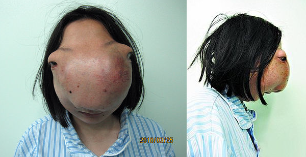 ▲ ⓒ 오스트리안타임즈 캡처.