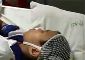 ▲ 쇠몽둥이로 맞은 초등학생 ⓒ&nbsp;온바오닷컴 &nbsp;