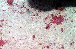 ▲ 중국에서 또 묻지마 칼부림 사건이 발생했다. ⓒ 온바오닷컴