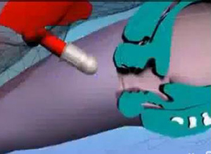 ▲ 강간 방지용 콘돔 ⓒ&nbsp;유코피아닷컴 캡처&nbsp;