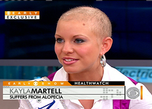 ▲ 카일라 마텔 ⓒ&nbsp; CBS화면 캡처