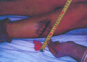▲ 군이 총상이라고 밝힌 한 희생자의 상처. ⓒ 자료사진