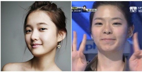 ▲ 장재인(우)과 남보라.