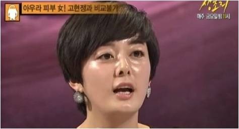 ▲ 화성인 바이러스 '피부녀' 방송화면