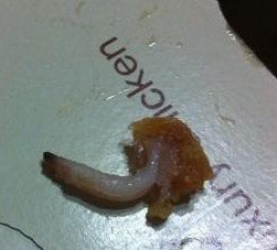 ▲ 유명 업체 A사의 치킨에서 애벌레가 발견됐다는 주장이 제기돼 논란이 되고 있다. ⓒ 엠엘비파크 캡쳐