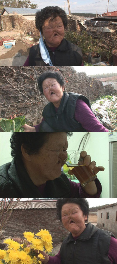 ▲ 코 없는 할머니의 안타까운 사연이 공개돼 시청자들을 뭉클하게 했다. ⓒSBS 화면 캡처