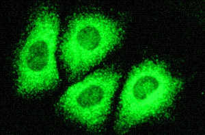 ▲ C형 간염균.ⓒ자료사진