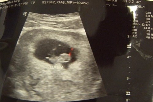 ▲ 추신수 선수의 아내 하원미씨가 임신 중인 셋째의 초음파 사진을 보고 있다.