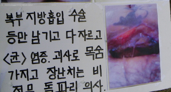 ▲ 불법 성형외과 시술을 받고 부작용이 생긴 사람들이 모여 만든 한 인터넷 카페에 올라온 피해 여성의 호소문 캡쳐 화면