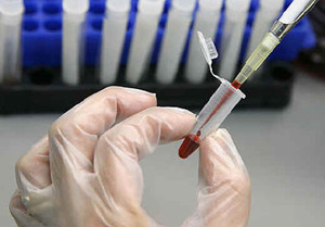 ▲ 에이즈와 증상이 아주 유사하지만 에이즈 바이러스가 검출되지 않는 괴질이 중국에서 급속도로 퍼지고 있다.ⓒSOH 캡처