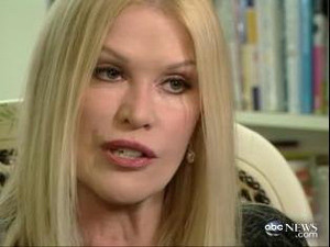 ▲ 성형수술 세계신기록 보유자인 신디 잭슨.ⓒABC 뉴스