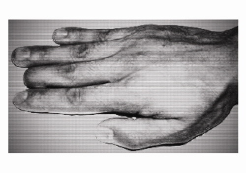 ▲ 신동혁씨의 손가락 사진 ⓒ세이지