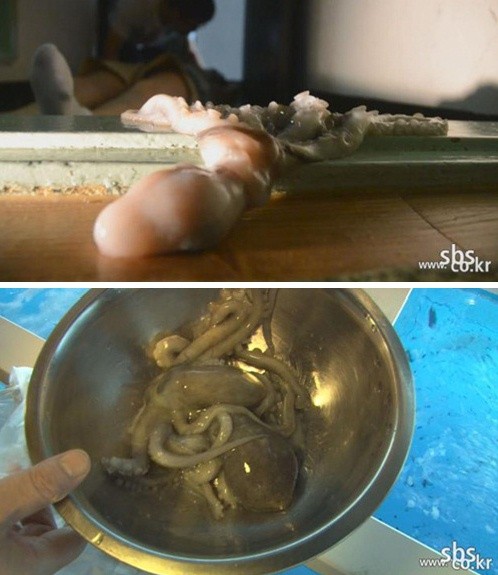 ▲ SBS TV ‘당신이 궁금한 이야기 Y’ 방송 화면 캡처.