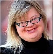 ▲ 다운증후군 환자의 모습ⓒ