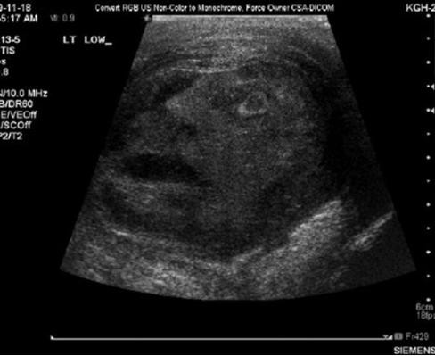 ▲ 일명 '암세포 악마의 얼굴' 사진이 발견돼 화제다. ⓒ 사진=온라인 커뮤니티