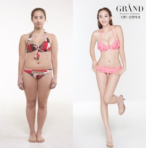 ▲ 최은이 전신성형으로 몰라보게 달라졌다.  ⓒ 사진=그랜드성형외과