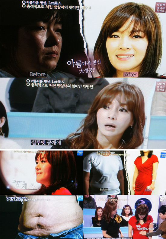 ▲ ‘렛미인’ 출연자 ‘처진 뱃살녀’가 ‘꿀복근녀’로 변신했다. ⓒ '렛미인' 방송화면 캡쳐