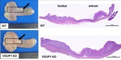 ▲ VDUP1 유전자가 결핍된 쥐(아래)와 그렇지 않은 정상 쥐(위)에서 헬리코박터 파일로리균의 감염으로 발생하는 위암 병변을 비교한 결과, VDUP1 유전자가 결핍된 쥐에서 암세포가 더 진행된 것을 확인했다.ⓒ
