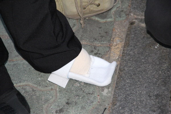 ▲ 탈북자 최 모씨는 탈북 때 동상으로 잃은 8개의 발가락으로 6년간 통증을 느끼다 최근 수술을 받고 이날 퇴원했다. 그는 이날 퇴원하자마자 바로 집회에 참석해 