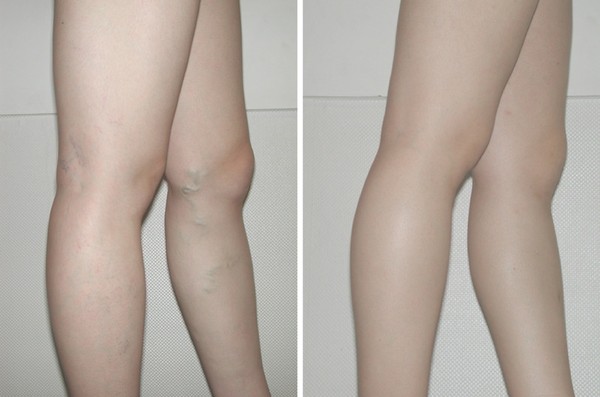 ▲ ⓒ시술 전과 후.