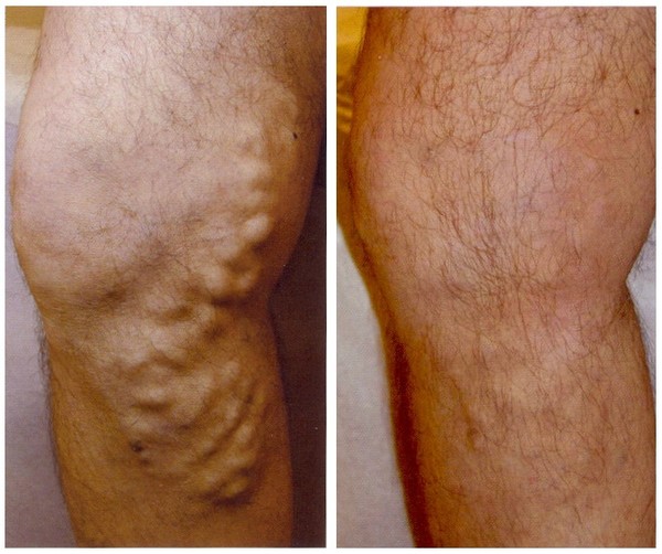 ▲ ⓒ시술 전과 후.