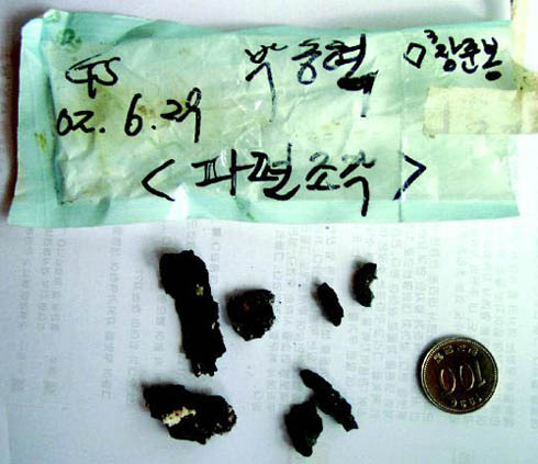 ▲ 고 박동혁 병장의 몸 속에 니온 파편조각들.ⓒ