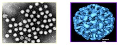 ▲ ⓒ노로바이러스.