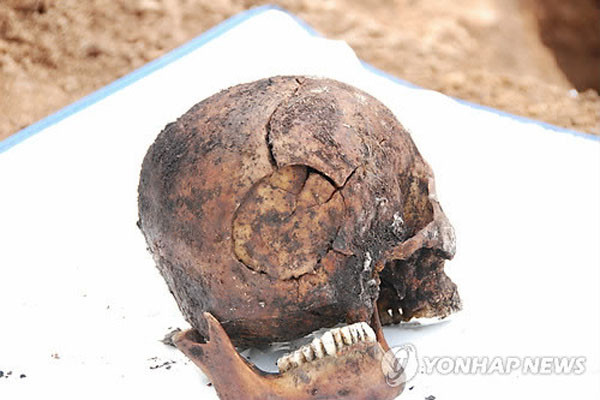 ▲ '장준하 추모공원 추진위원회' 등이 공개한 故장준하의 두개골.