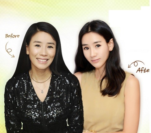 ▲ ⓒ그랜드성형외과 사이트