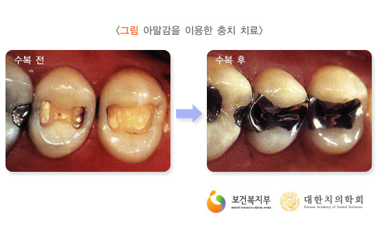 ▲ 양승오 동남권원자력의학원 암센터 핵의학과 주임과장. ⓒ이종현 기자