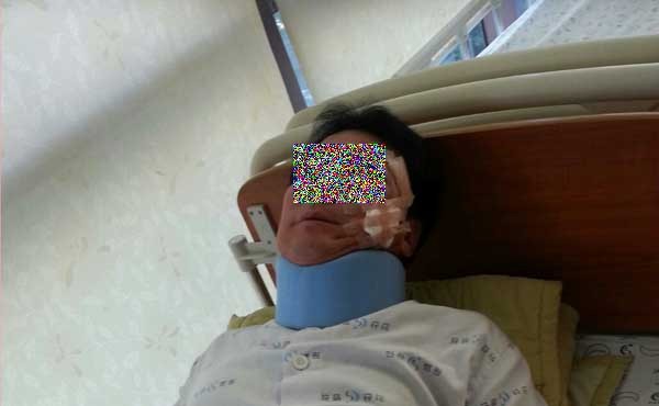 ▲ 희망버스 시위대의 죽창에 얼굴을 찔리고, 뺨 관통상을 당한 현대차 보안직원 이 모 씨.