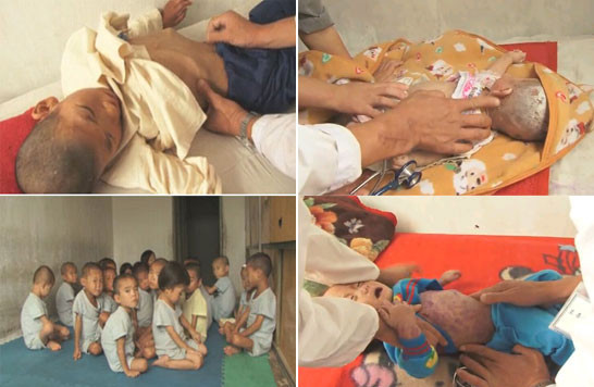 ▲ 북한을 방문한 세계식량계획의 아시아 책임자 켄로 오쉬다리 국장은 "북한 어린이들이 풀죽 등으로 연명하는 실정이며 필요한 단백질 섭취를 못 해 걱정"이라고 말해 북한의 심각한 식량난을 걱정한 바 있다. ⓒ 세계식량계획(WFP)