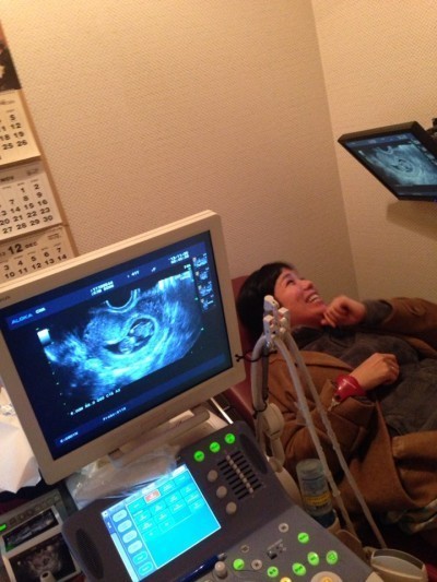 ▲ 초음파로 2세를 확인하고 있는 김송