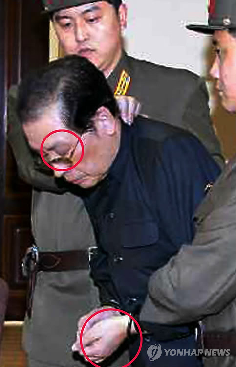 ▲ 북한 김정은 정권의 '2인자'로 불렸던 장성택이 군사재판 피고인석에서 양손이 수갑 같은 것에 묶이고 국가안전보위부원으로 보이는 2명에게 목과 팔을 잡힌 채 선 초라한 모습. 특히 왼쪽 눈두덩이 부어오르고 멍이 든 것처럼 보이며 입과 손에도 구타 흔적 같은 것이 있어 장성택이 조사 과정에서 구타를 당했을 수 있음을 짐작하게 한다. ⓒ연합뉴스