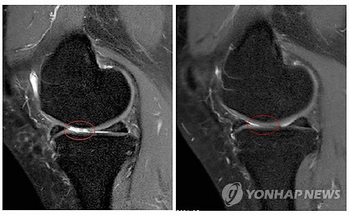 ▲ 아래 기사내용과는 무관함