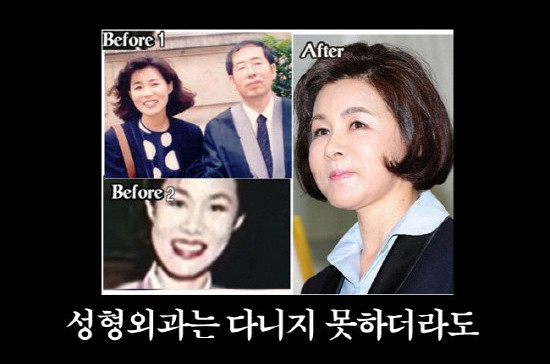 ▲ 강난희 여사 과거 사진과 2011년 사진 비교 사진은=웹사이트 캡쳐