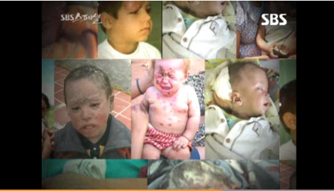 ▲ [SBS스페셜] "농약 중독, 한국도 조심하라" ⓒ방송화면 캡처