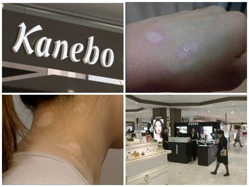 ▲ ⓒ사진=BBC 뉴스 화면 캡처