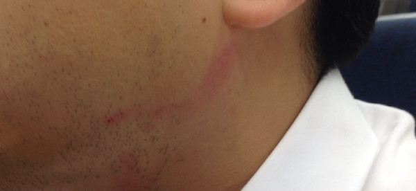 ▲ 세월호 국민대책회의 소속 김태섭씨에게 폭행당한 나경원 후보 측 관계자.