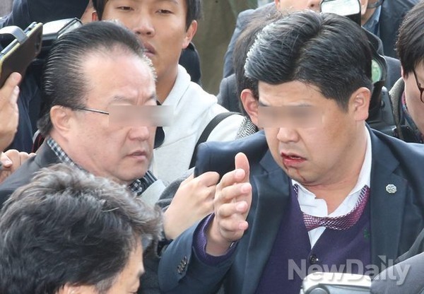 ▲ 강기정 의원에게 박치기를 당해 입에서 피가 철철 흐르는 경호원 모습.ⓒ뉴데일리