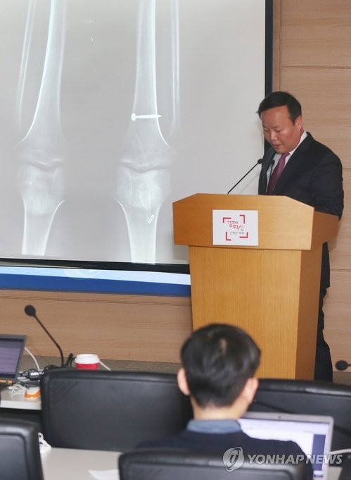 ▲ ▲이완구 국무총리 후보자의 청문회 준비를 지원하고 있는 새누리당 김재원 원내수석부대표가 24일 오후 서울 종로구 세종로 서울정부청사에서 열린 브리핑에서 이 후보자 차남의 병역문제에 대한 의혹과 관련해 엑스레이 사진을 공개하고 있다. 김 원내수석부대표는 이날 "'우측 무릎 전방 십자인대 완전파열'로 인한 것"이라며 "아직도 이론 제기가 있다면 언론인 앞에서 공개리에 다시 X선 촬영 등 모든 증빙을 함께 실시할 용의가 있다"고 밝혔다.ⓒ연합뉴스
